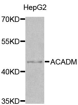 MCAD / ACADM Antibody - Western blot analysis of extracts of HepG2 cell line, using ACADM antibody.