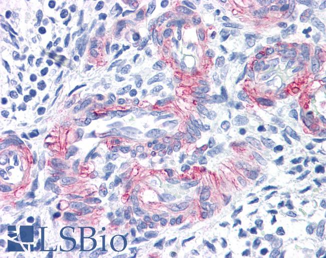 MCAM / CD146 Antibody - Anti-MCAM / CD146 antibody IHC of human vessels in human uterus. Immunohistochemistry of formalin-fixed, paraffin-embedded tissue after heat-induced antigen retrieval. Antibody concentration 20 ug/ml.