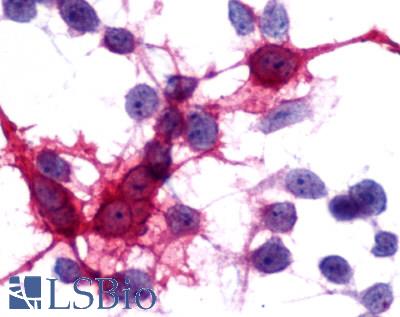 MCHR2 Antibody - Anti-MCHR2 antibody immunocytochemistry (ICC) staining of HEK293 human embryonic kidney cells transfected with MCHR2.