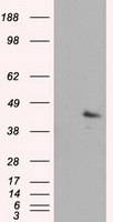 MCL1 / MCL 1 Antibody - HEK293T cells were transfected with the pCMV6-ENTRY control (Left lane) or pCMV6-ENTRY MCL1 (Right lane) cDNA for 48 hrs and lysed. Equivalent amounts of cell lysates (5 ug per lane) were separated by SDS-PAGE and immunoblotted with anti-MCL1.