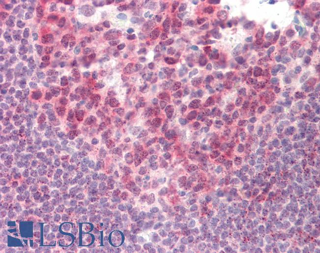 MCL1 / MCL 1 Antibody - Anti-MCL1 / MCL 1 antibody IHC staining of human tonsil. Immunohistochemistry of formalin-fixed, paraffin-embedded tissue after heat-induced antigen retrieval. Antibody concentration 10 ug/ml.