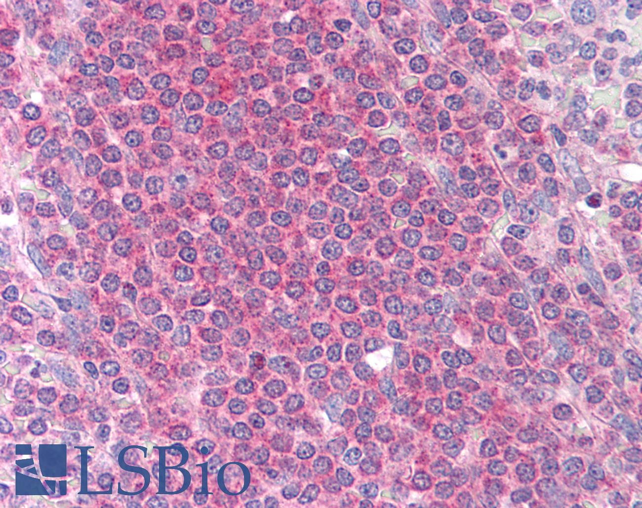 MCL1 / MCL 1 Antibody - Anti-MCL1 antibody IHC of human spleen. Immunohistochemistry of formalin-fixed, paraffin-embedded tissue after heat-induced antigen retrieval. Antibody dilution 1:200.
