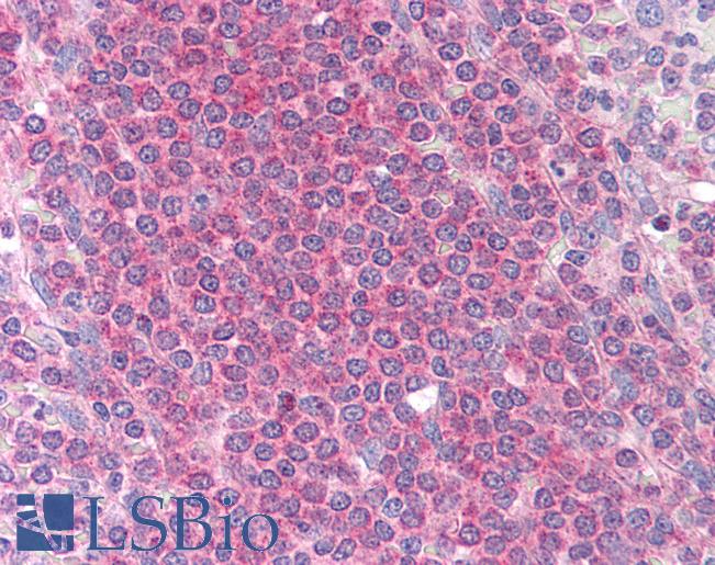 MCL1 / MCL 1 Antibody - Anti-MCL1 antibody IHC of human spleen. Immunohistochemistry of formalin-fixed, paraffin-embedded tissue after heat-induced antigen retrieval. Antibody dilution 1:200.