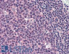 MCL1 / MCL 1 Antibody - Anti-MCL1 antibody IHC of human tonsil. Immunohistochemistry of formalin-fixed, paraffin-embedded tissue after heat-induced antigen retrieval. Antibody concentration 10 ug/ml.
