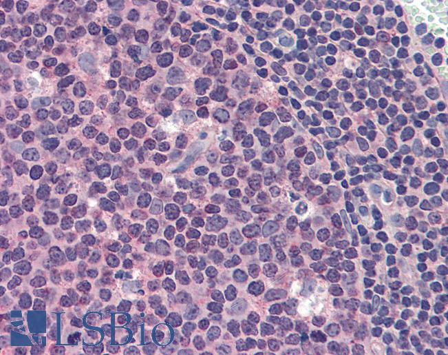 MCL1 / MCL 1 Antibody - Anti-MCL1 antibody IHC of human tonsil. Immunohistochemistry of formalin-fixed, paraffin-embedded tissue after heat-induced antigen retrieval. Antibody concentration 10 ug/ml.