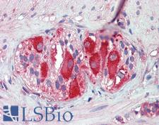 MCL1 / MCL 1 Antibody - Anti-MCL1 antibody IHC of human small intestine, myenteric plexus. Immunohistochemistry of formalin-fixed, paraffin-embedded tissue after heat-induced antigen retrieval. Antibody concentration 10 ug/ml.