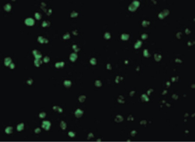 MCL1 / MCL 1 Antibody - Immunofluorescence of Mcl-1 in Raji cells with Mcl-1 antibody at 10 ug/ml.