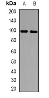 MCM10 Antibody - Western blot analysis of MCM10 expression in MCF7 (A); mouse liver (B) whole cell lysates.