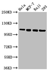 MCM2 Antibody - Western Blot Positive WB detected in: Hela whole cell lysate, MCF-7 whole cell lysate, Raji whole cell lysate, 293 whole cell lysate All lanes: MCM2 antibody at 4.8µg/ml Secondary Goat polyclonal to rabbit IgG at 1/50000 dilution Predicted band size: 102 kDa Observed band size: 102 kDa