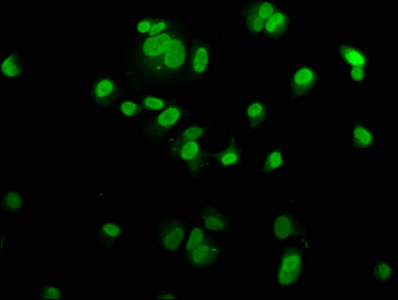 MCM2 Antibody - Immunofluorescence staining of MCF-7 cells with MCM2 Antibody at 1:200, counter-stained with DAPI. The cells were fixed in 4% formaldehyde, permeabilized using 0.2% Triton X-100 and blocked in 10% normal Goat Serum. The cells were then incubated with the antibody overnight at 4°C. The secondary antibody was Alexa Fluor 488-congugated AffiniPure Goat Anti-Rabbit IgG(H+L).
