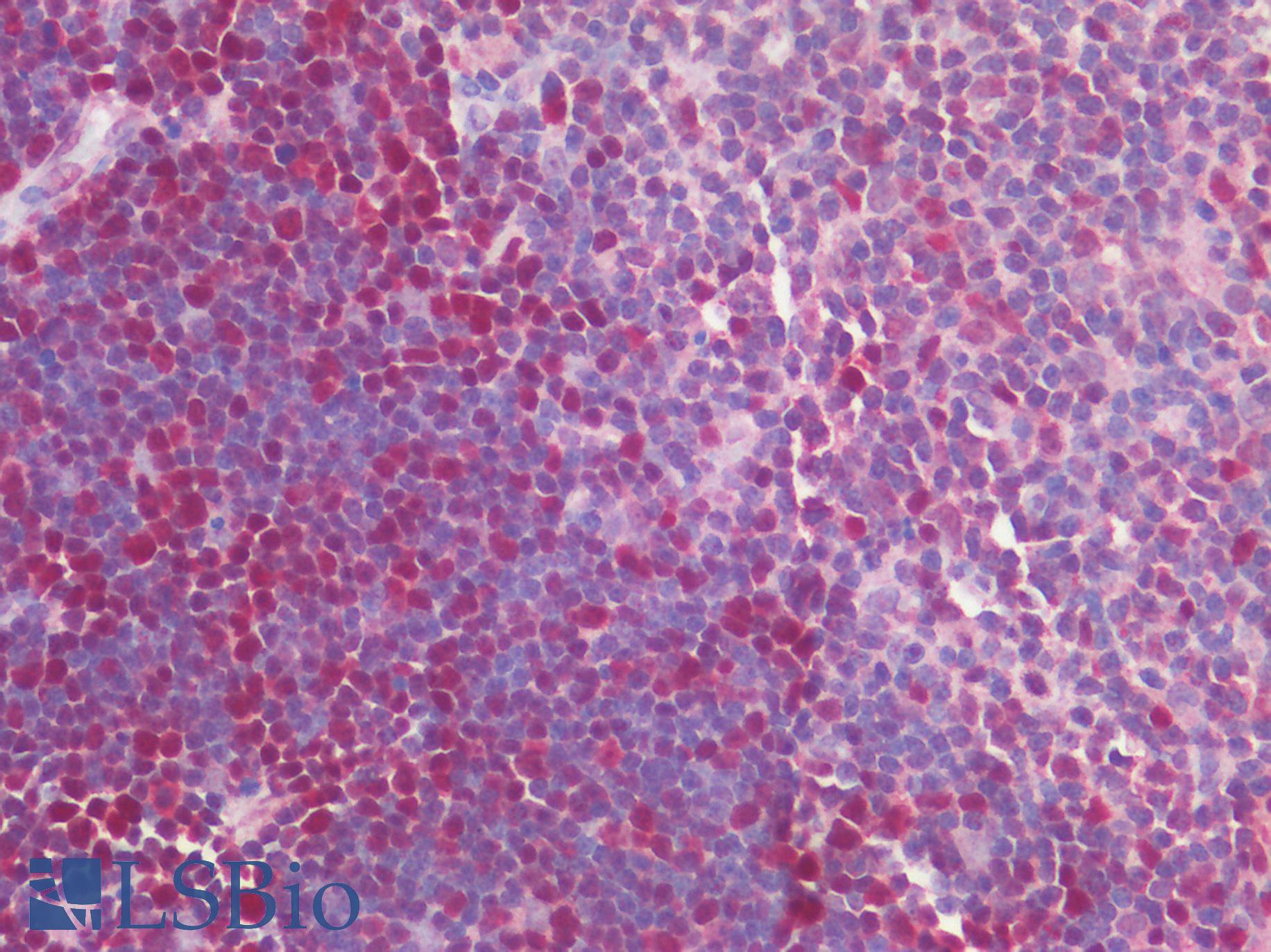 MCM4 Antibody - Human Thymus: Formalin-Fixed, Paraffin-Embedded (FFPE)
