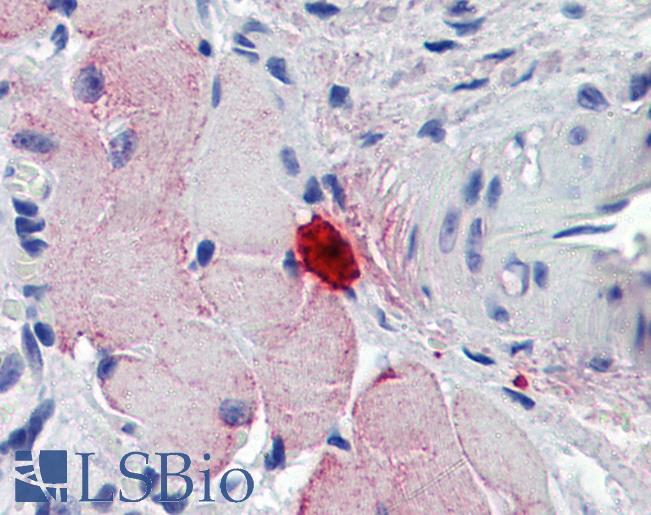 Mcpt4 Antibody - Anti-MCPT4 antibody IHC of mouse skeletal muscle, mast cell. Immunohistochemistry of formalin-fixed, paraffin-embedded tissue after heat-induced antigen retrieval. Antibody concentration 3.75 ug/ml.