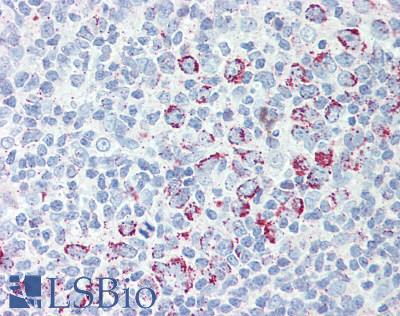 MCTS1 Antibody - Human Tonsil: Formalin-Fixed, Paraffin-Embedded (FFPE)