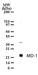 MD-1 / LY86 Antibody - Western blot of MD-1 in cell lysates from Ramos using antibody at 2 ug/ml dilution.