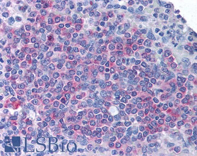 MD-1 / LY86 Antibody - Anti-LY86 / MD-1 antibody IHC of human spleen. Immunohistochemistry of formalin-fixed, paraffin-embedded tissue after heat-induced antigen retrieval. Antibody concentration 5 ug/ml.