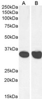 MDH / MDH2 Antibody - Antibody (0.03µg/ml) staining of Human Heart (A) and Liver (B) lysate (35µg protein in RIPA buffer). Primary incubation was 1 hour. Detected by chemiluminescence.