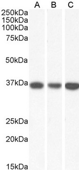 MDH / MDH2 Antibody - Goat anti-MDH2 (aa221-232) Antibody (0.03µg/ml) staining of HeLa (A), HepG2 (B) and K562 (C) lysate (35µg protein in RIPA buffer). Primary incubation was 1 hour. Detected by chemiluminescencence.
