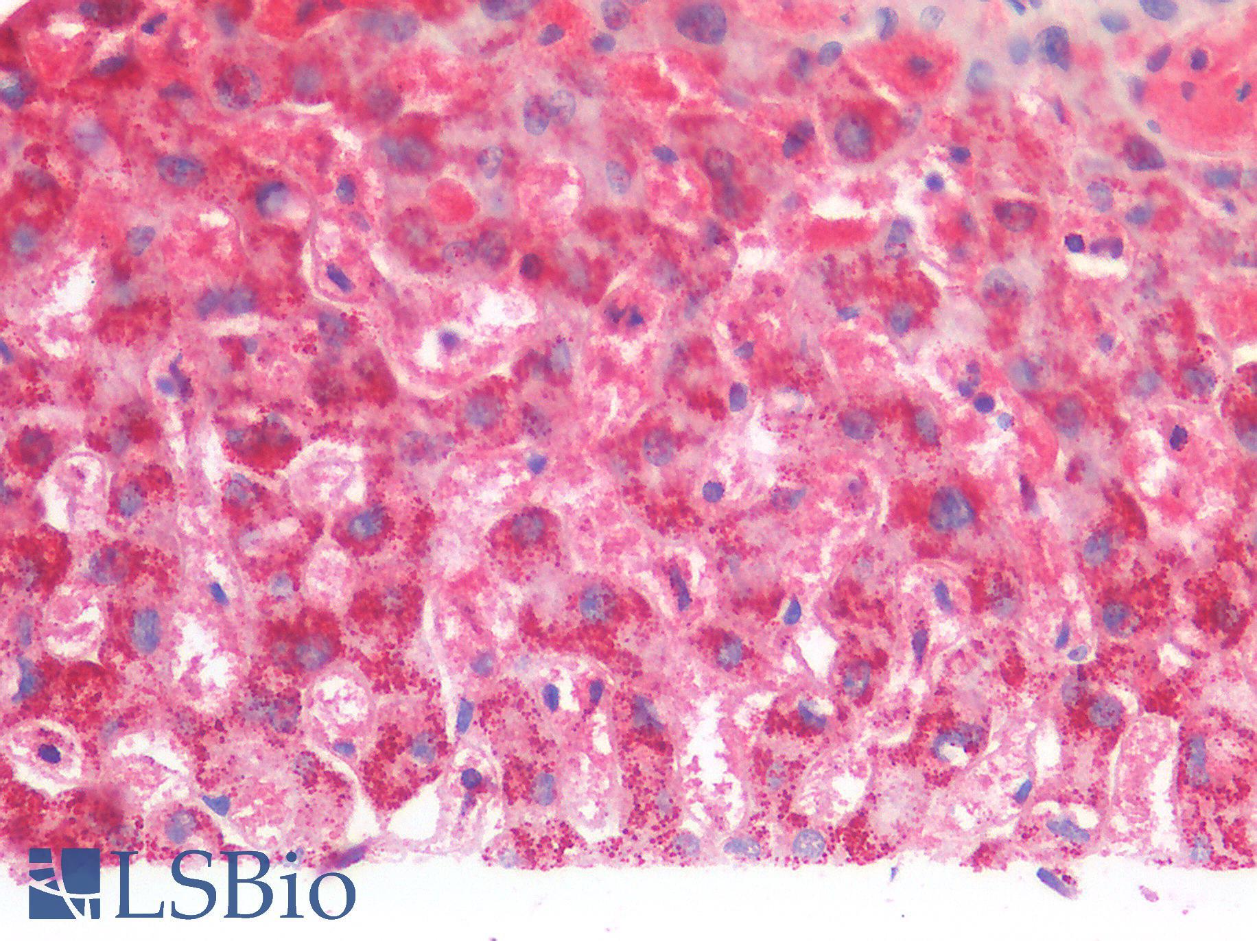 MDH / MDH2 Antibody - Human Liver: Formalin-Fixed, Paraffin-Embedded (FFPE)