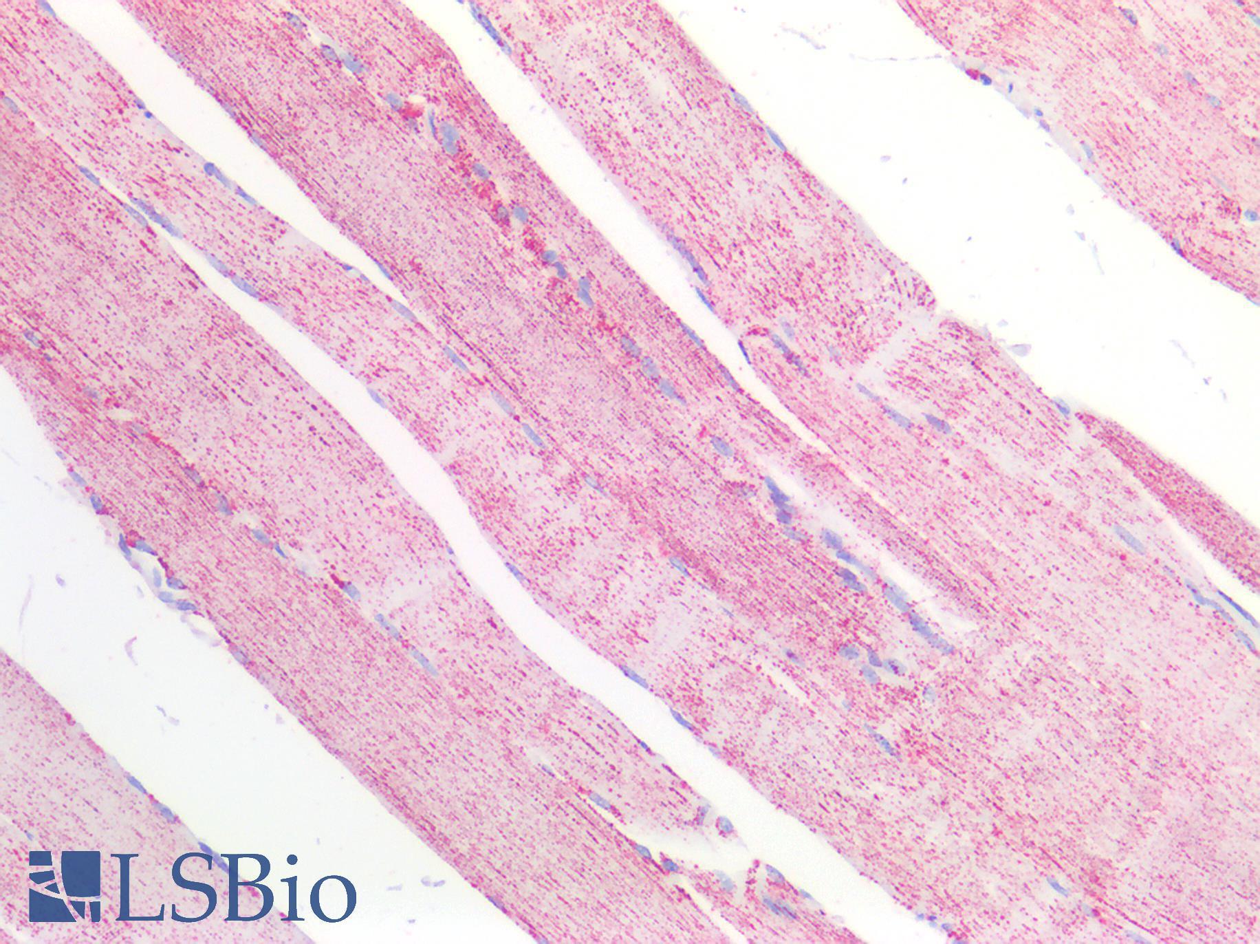 MDH / MDH2 Antibody - Human Skeletal Muscle: Formalin-Fixed, Paraffin-Embedded (FFPE)