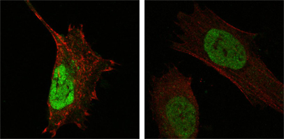 MDM4 / MDMX Antibody - Confocal immunofluorescence of HeLa (left) and L-02 (right) cells using MDM4 mouse monoclonal antibody (green). Red: Actin filaments have been labeled with DY-554 phalloidin.