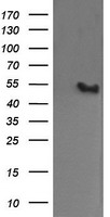 MDM4 / MDMX Antibody - HEK293T cells were transfected with the pCMV6-ENTRY control (Left lane) or pCMV6-ENTRY MDM4 (Right lane) cDNA for 48 hrs and lysed. Equivalent amounts of cell lysates (5 ug per lane) were separated by SDS-PAGE and immunoblotted with anti-MDM4.