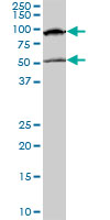 MECP2 Antibody - MECP2 monoclonal antibody clone 4B6. Western blot of MECP2 expression in NIH/3T3.