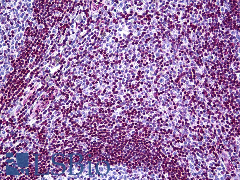 MECP2 Antibody - Anti-MECP2 antibody IHC of human tonsil. Immunohistochemistry of formalin-fixed, paraffin-embedded tissue after heat-induced antigen retrieval. Antibody concentration 5 ug/ml.