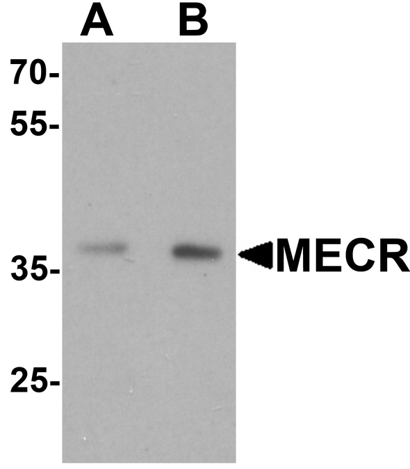 MECR Antibody - Western blot analysis of MECR in human brain tissue lysate with MECR antibody at (A) 1 and (B) 2 ug/ml.