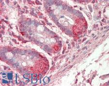 MED1 / TRAP220 Antibody - Human Small Intestine: Formalin-Fixed, Paraffin-Embedded (FFPE)