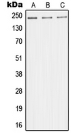 MED1 / TRAP220 Antibody - Western blot analysis of TRAP220 expression in HeLa (A); HUVEC (B); Jurkat (C) whole cell lysates.