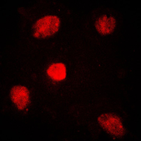 MED1 / TRAP220 Antibody - Immunofluorescent analysis of TRAP220 staining in HUVEC cells. Formalin-fixed cells were permeabilized with 0.1% Triton X-100 in TBS for 5-10 minutes and blocked with 3% BSA-PBS for 30 minutes at room temperature. Cells were probed with the primary antibody in 3% BSA-PBS and incubated overnight at 4 C in a humidified chamber. Cells were washed with PBST and incubated with a DyLight 594-conjugated secondary antibody (red) in PBS at room temperature in the dark. DAPI was used to stain the cell nuclei (blue).