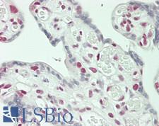 MED12 Antibody - Human Placenta: Formalin-Fixed, Paraffin-Embedded (FFPE)