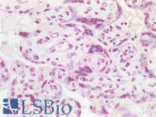 MED13L Antibody - Human Placenta: Formalin-Fixed, Paraffin-Embedded (FFPE)