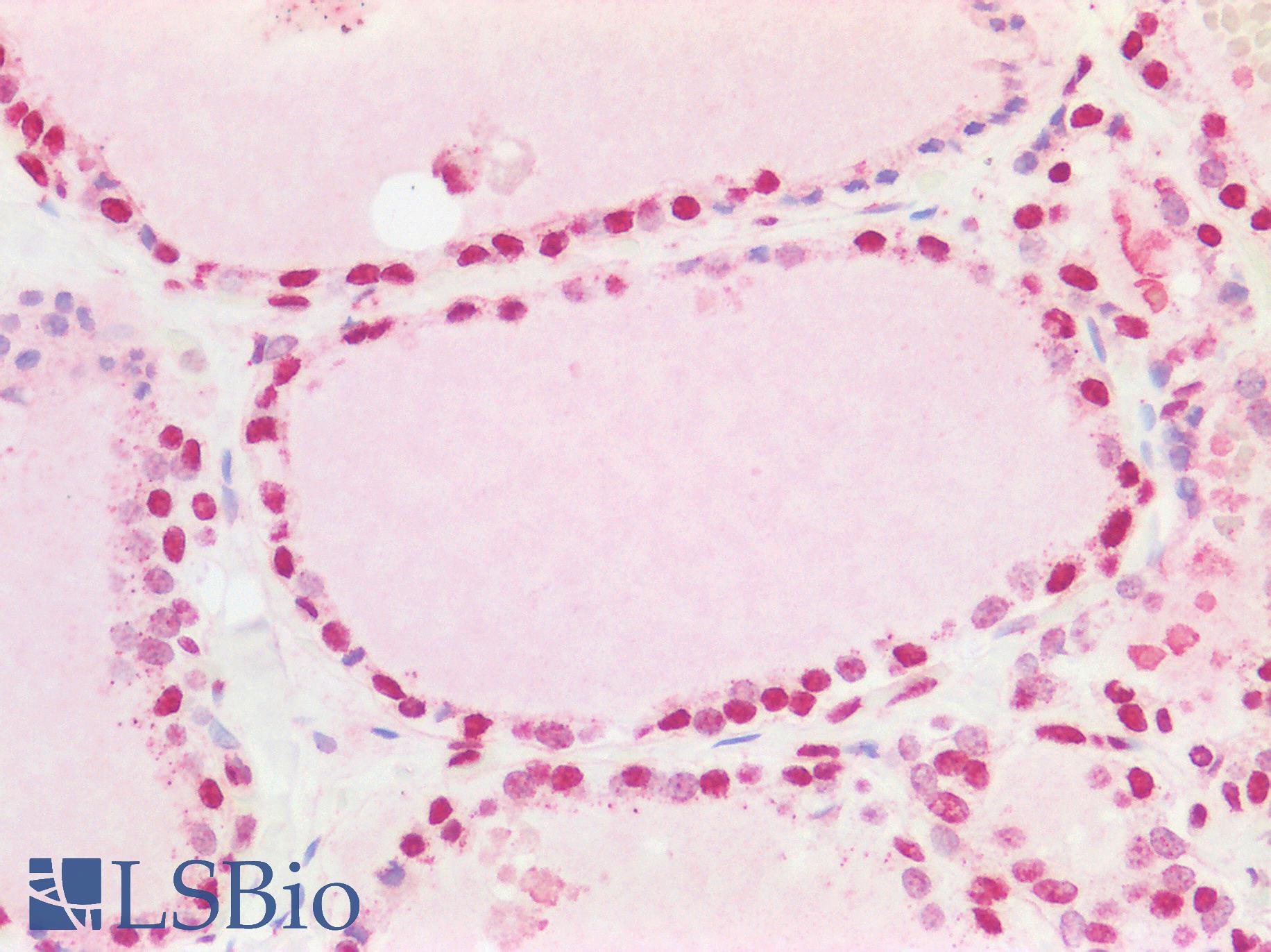 MED13L Antibody - Human Thyroid: Formalin-Fixed, Paraffin-Embedded (FFPE)