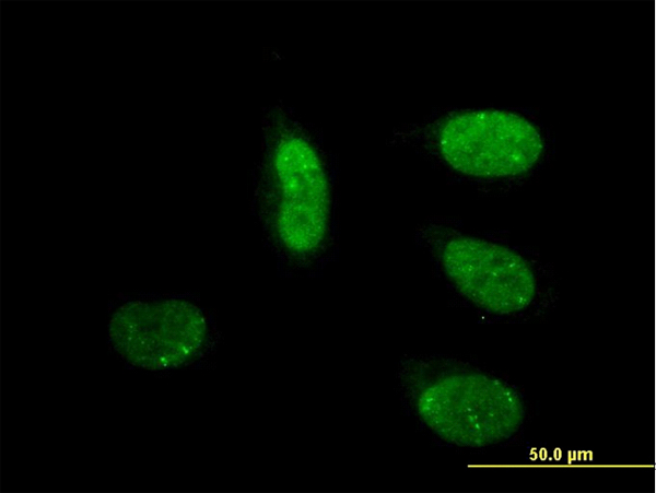 MED17 / TRAP80 Antibody - Immunofluorescence of monoclonal antibody to CRSP6 on HeLa cell. [antibody concentration 10 ug/ml]