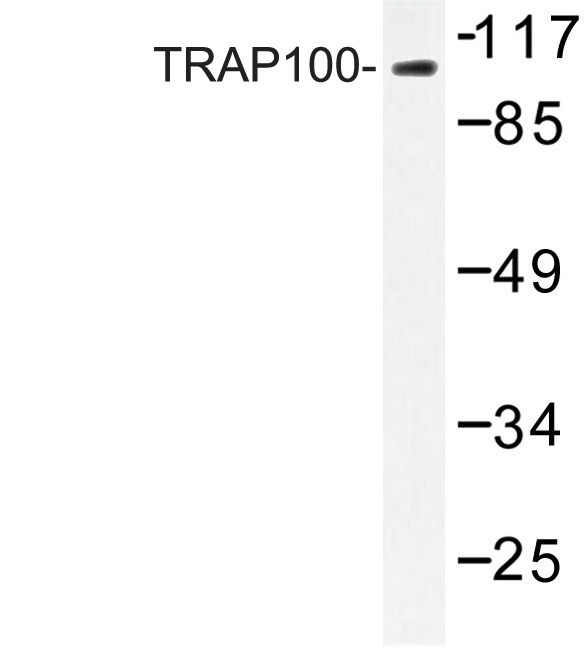 MED24 / TRAP100 Antibody - Western blot of TRAP100 (K834) pAb in extracts from 293 cells.
