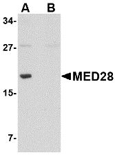 MED28 / Magicin Antibody - Western blot of MED28 in human brain tissue lysate with MED28 antibody at 1 ug/ml in (A) the absence and (B) the presence of blocking peptide.