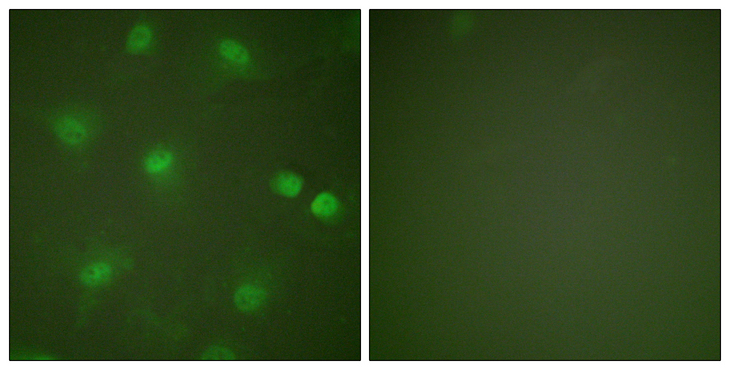MEF2A / MEF2 Antibody - Immunofluorescence analysis of HeLa cells, using MEF2A Antibody. The picture on the right is blocked with the synthesized peptide.