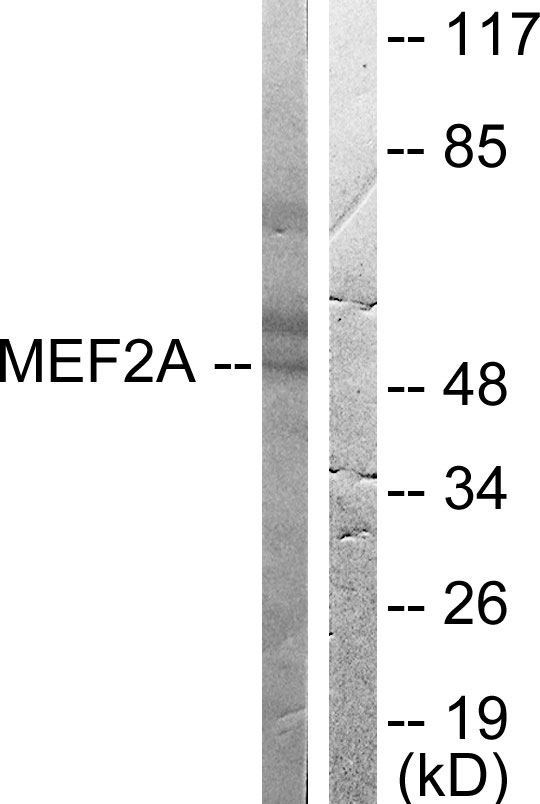 MEF2A / MEF2 Antibody - Western blot analysis of lysates from HeLa cells, treated with PMA 125ng/ml 30', using MEF2A Antibody. The lane on the right is blocked with the synthesized peptide.