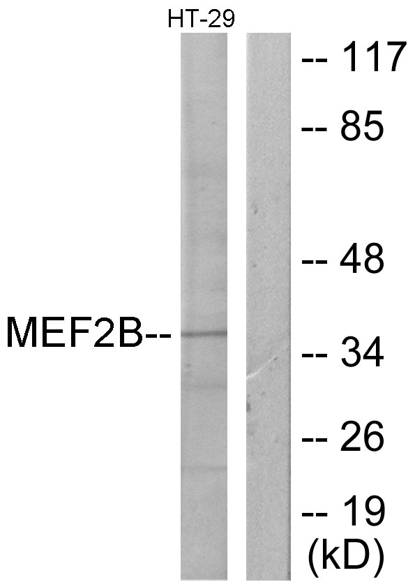 MEF2B Antibody - Western blot analysis of lysates from HT-29 cells, using MEF2B Antibody. The lane on the right is blocked with the synthesized peptide.