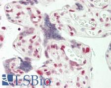 MEF2C Antibody - Human Placenta: Formalin-Fixed, Paraffin-Embedded (FFPE)