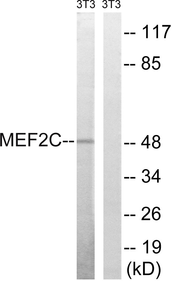 MEF2C Antibody - Western blot analysis of lysates from NIH/3T3 cells, treated with starved 24h, using MEF2C Antibody. The lane on the right is blocked with the synthesized peptide.