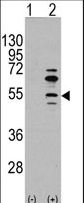 MEF2C Antibody - Western blot of MEF2C (arrow) using rabbit polyclonal MEF2C Antibody (S59) (RB11081). 293 cell lysates (2 ug/lane) either nontransfected (Lane 1) or transiently transfected with the MEF2C gene (Lane 2) (Origene Technologies).