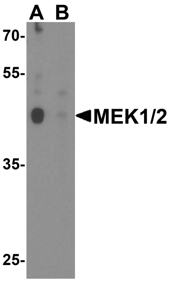 MEK1 + MEK2 Antibody - Western blot analysis of MEK1/2 in human brain tissue lysate with MEK1/2 antibody at 1 ug/ml in (A) the absence and (B) the presence of blocking peptide.