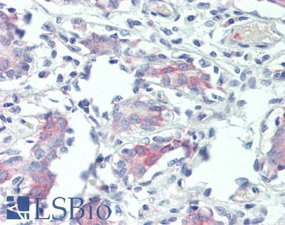 MELK Antibody - Human Breast: Formalin-Fixed, Paraffin-Embedded (FFPE), at a concentration of 5 ug/ml. 
