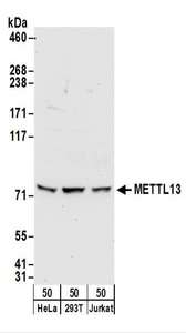 METTL13 / KIAA0859 Antibody - Detection of Human METTL13 by Western Blot. Samples: Whole cell lysate (50 ug) from HeLa, 293T, and Jurkat cells. Antibodies: Affinity purified rabbit anti-METTL13 antibody used for WB at 0.4 ug/ml. Detection: Chemiluminescence with an exposure time of 30 seconds.
