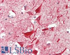 METTL13 / KIAA0859 Antibody - Human Brain, Cortex: Formalin-Fixed, Paraffin-Embedded (FFPE)