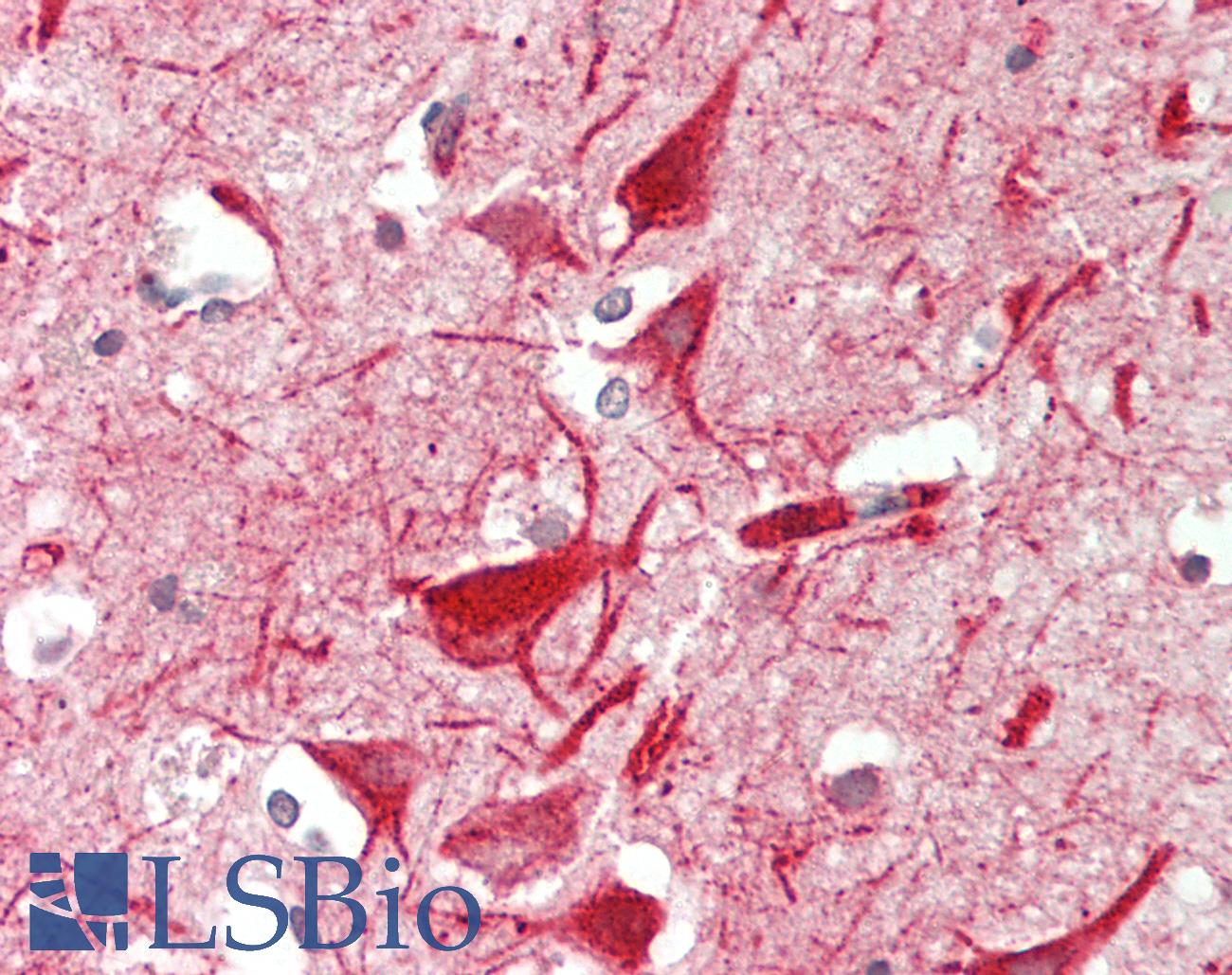 METTL13 / KIAA0859 Antibody - Human Brain, Cortex: Formalin-Fixed, Paraffin-Embedded (FFPE)