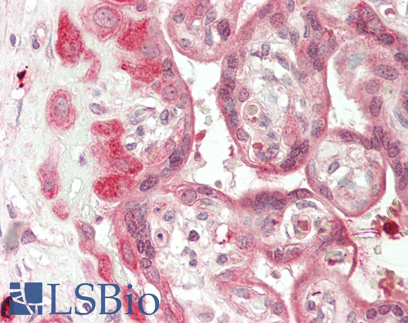 METTL13 / KIAA0859 Antibody - Human Placenta: Formalin-Fixed, Paraffin-Embedded (FFPE)
