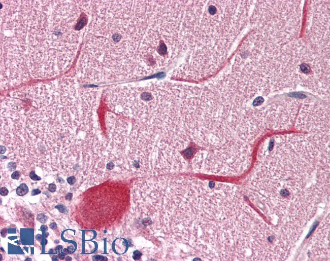 METTL14 Antibody - Human Cerebellum: Formalin-Fixed, Paraffin-Embedded (FFPE)